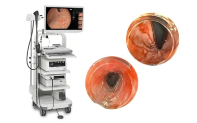 Fujifilm Receives ‘Best New Endoscopy Technology Solution’ Award 