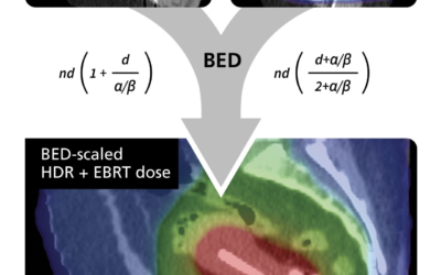 MIM ComboTherapy GYN HDR/EBRT to Advance Precision in Gynecologic Cancer Care