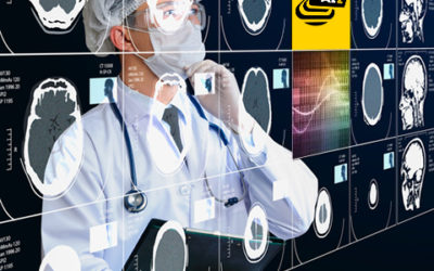 Zebra Medical Vision joins forces with Nuance to bring more AI to diagnostic imaging