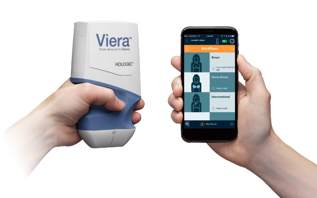 Hologic Viera Portable Breast Ultrasound System